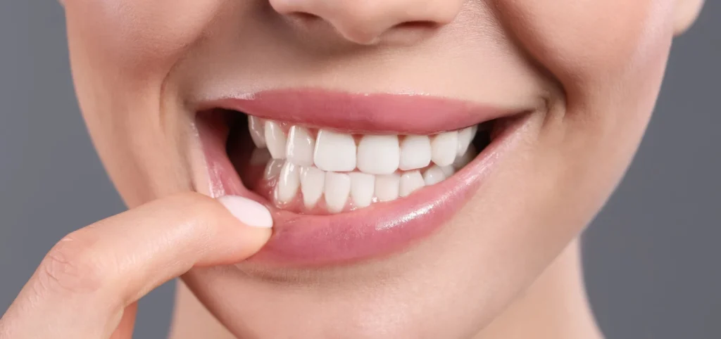 soins gencives detartrage Parodontite : la maladie des gencives Cabinet dentaire NACRE - Dentistes à Saint-Jacques-de-la-Lande